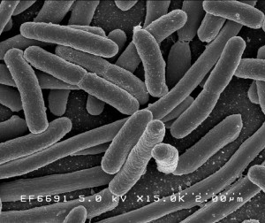 EscherichiaColi-NIAID