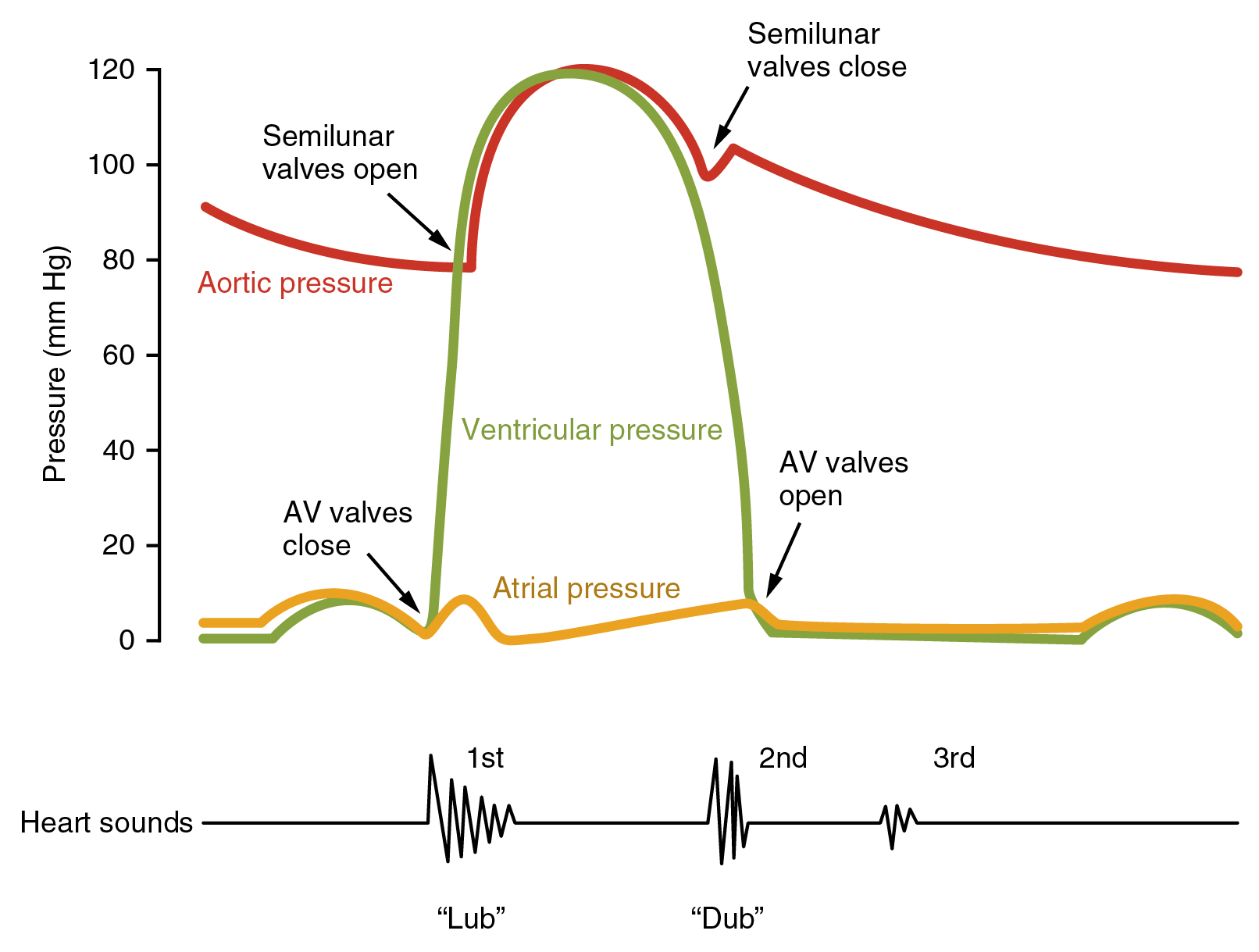 Heart Sounds Origin Timing And Murmurs Medical Library