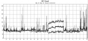 Heart rate diagram of a Holter recording showing an episode of atrial fibrillation Heart rate diagram of a Holter recording showing an episode of atrial fibrillation