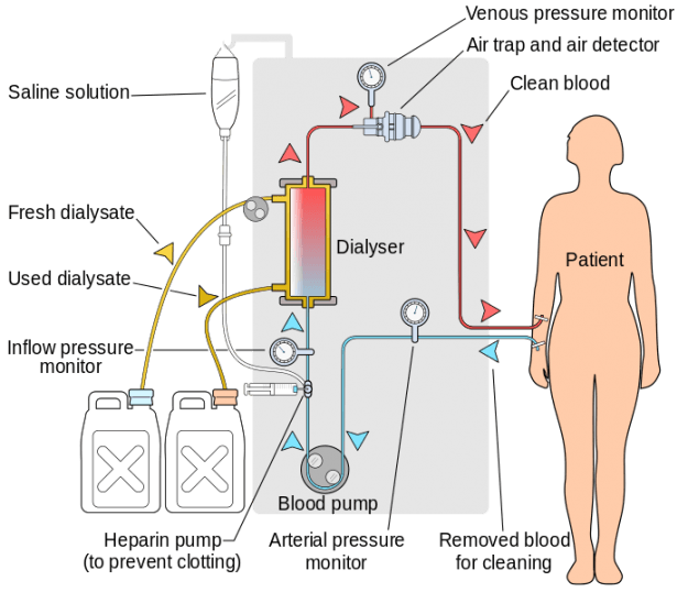 renal-replacement-therapy-overview-online-medical-library