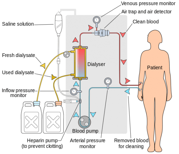 Renal Replacement Therapy Overview Online Medical Library