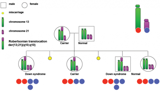 Hereditary Down Syndrome Translocation Hereditary Down Syndrome Translocation