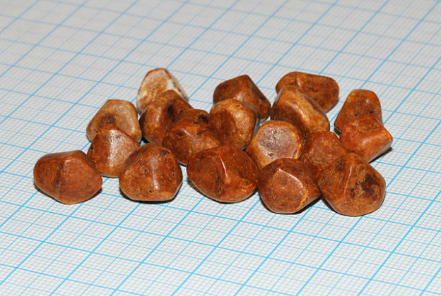 Calculi biliari umani