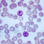 Photomicrograph of a blood smear containing both immature and mature trophozoites of the Plasmodium vivax parasite Photomicrograph of a blood smear containing both immature and mature trophozoites of the Plasmodium vivax parasite