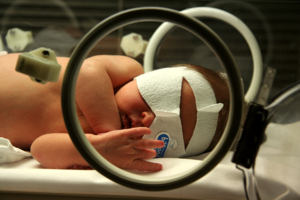 newborn-infant-undergoing-phototherapy-to-treat-neonatal-jaundice