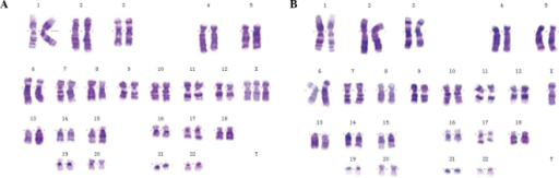 Karyotyping of a whole blood sample from a patient