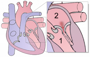 slight mitral insufficiency