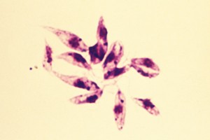 Under the acellular culture condition, the protozoa transforms into the form of promastigote, a flagellated and elongated morphology seen in the mid-gut of the vector. Under the acellular culture condition, the protozoa transforms into the form of promastigote, a flagellated and elongated morphology seen in the mid-gut of the vector.