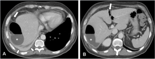 MDCT of upper abdomen - imaging studies