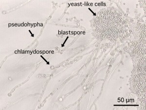Microscopic image (200-fold magnification) of Candida albicans ATCC 10231