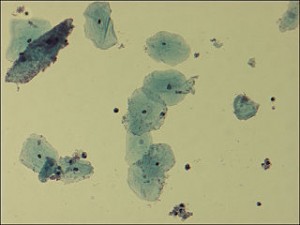 Microscopic view of Gardnerella vaginalis