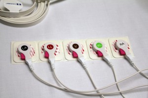 Monitoring electrode Monitoring electrode