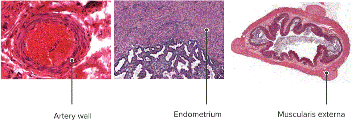 Muscle regenerate
