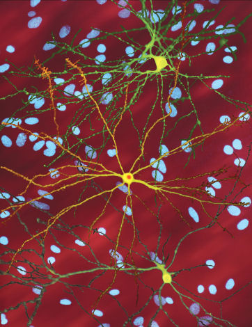 Neuron with mHtt inclusion