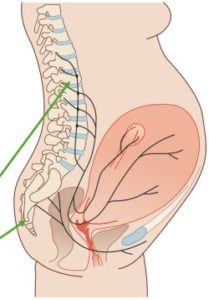 Obstetrical Pain