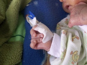 Overlapping fingers Overlapping fingers