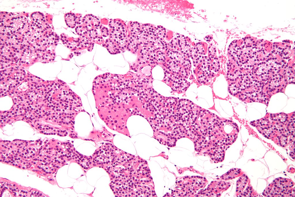 Parathyroid Diseases: Hyperparathyroidism and Hypoparathyroidism