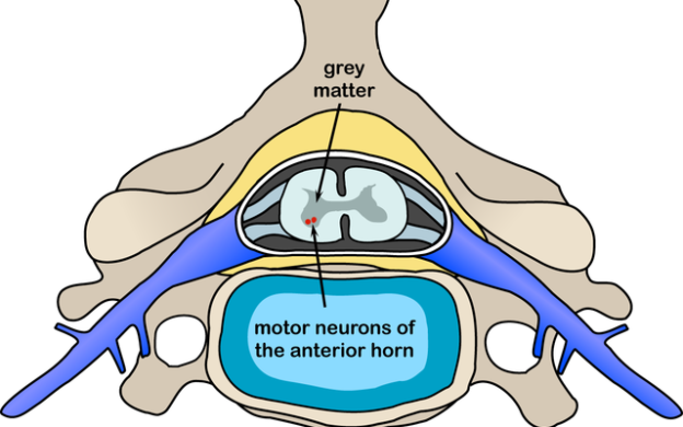 Polio_spinal_diagram