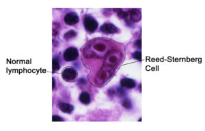 By Unknown - National Cancer Institute, AV Number: CDR576466, Public Domain, https://commons.wikimedia.org/w/index.php?curid=5580965