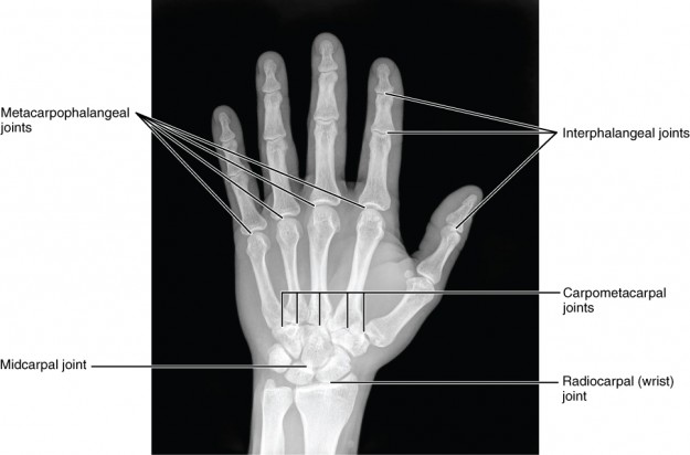 Radiograph of Hand