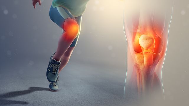 Patellofemoral Pain Syndrome Symptoms And Treatment Lecturio