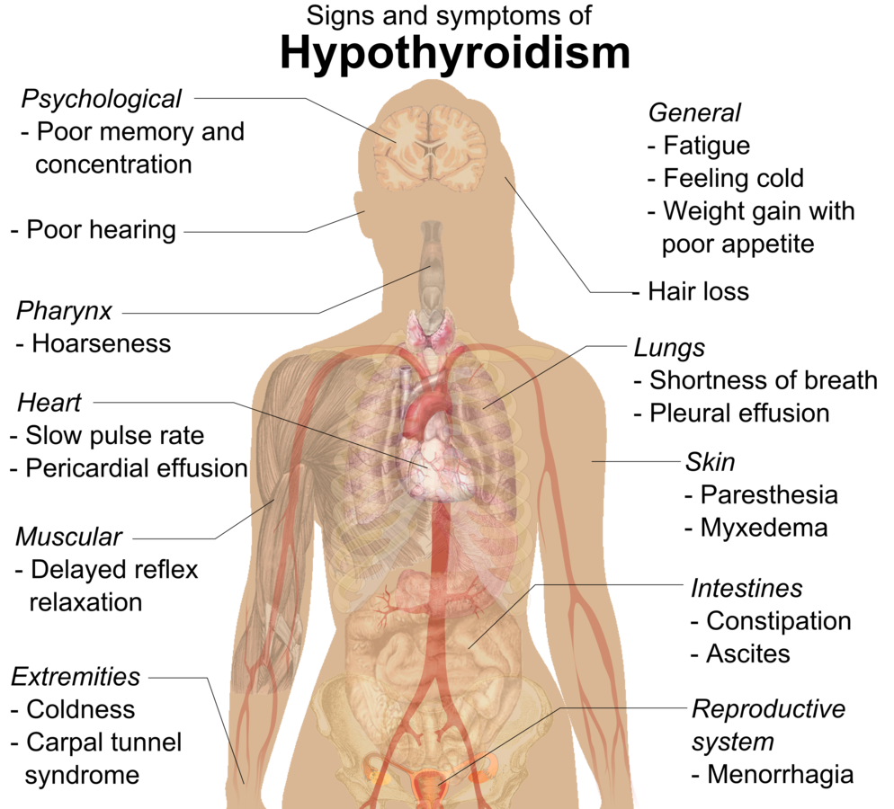 Hypothyroidism Underactive Thyroid Medication And TSH Levels