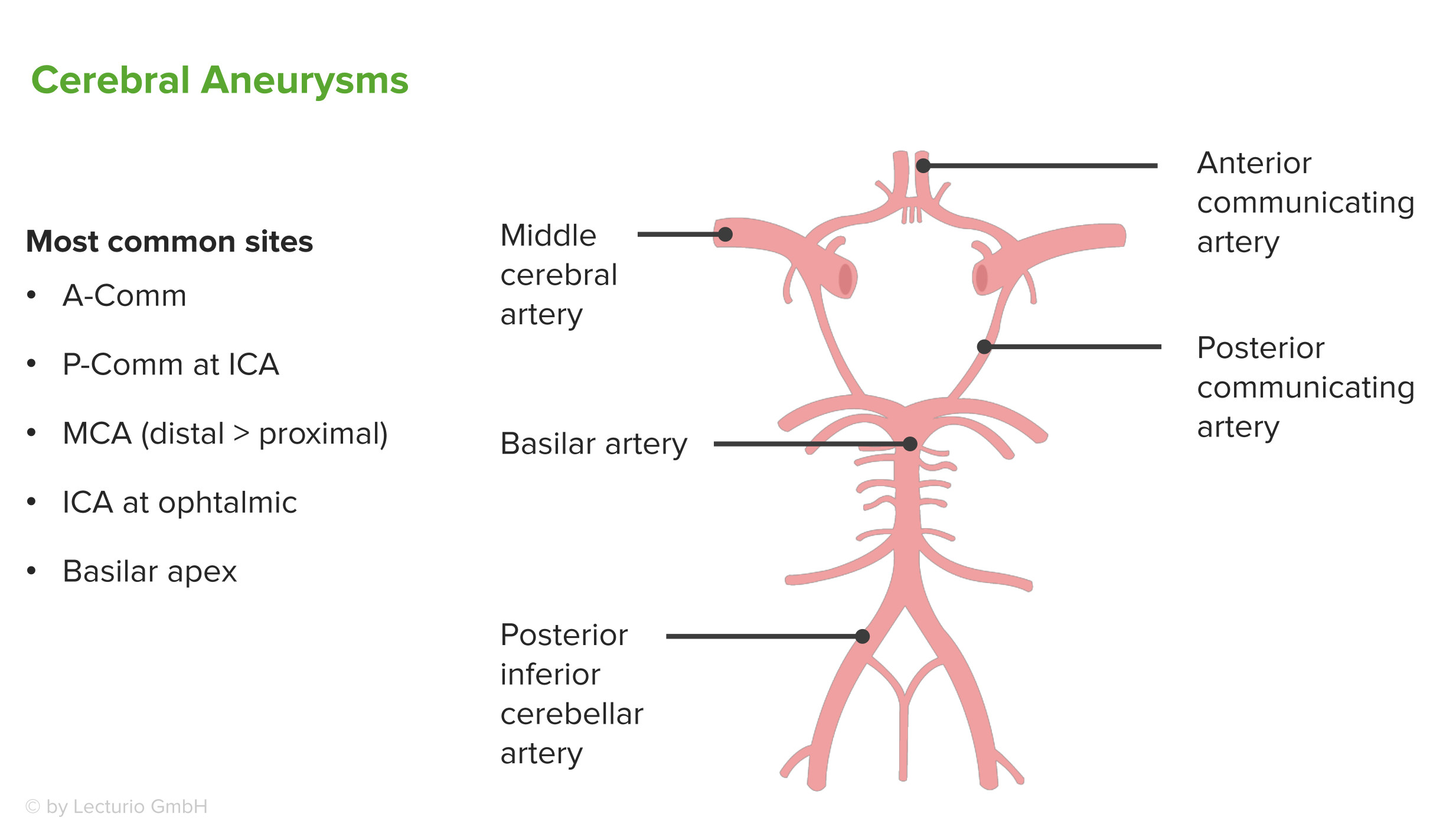 Intercranial Aneurysm (Cerebral Aneurysm) — Symptoms and ...