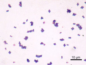Staphylococcus aureus gram stain