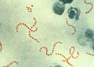 Streptococcus pyogenes Streptococcus pyogenes