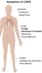 Symptoms of COPD Symptoms of COPD