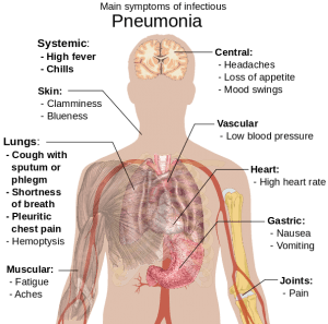Symptoms-of-pneumonia.svg