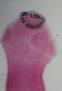 taenia solium scolex