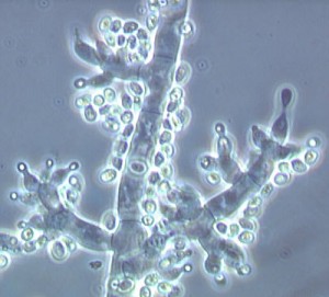 Trichoderma fertile Trichoderma fertile