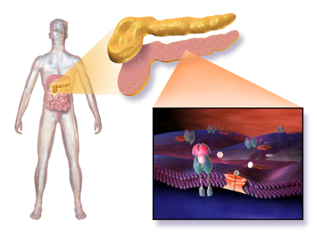 Type 1 Diabetes