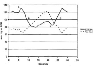 Systolic blood pressure and pulse rate changes during Valsalva maneuver