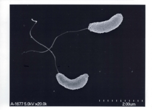 Vibrio cholerae