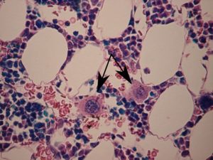 Megakaryocytes