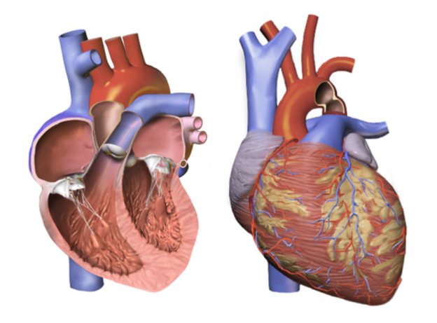 aortic coarctation