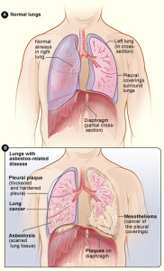 asbestos effect