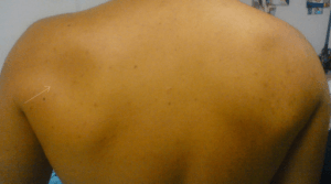 both shoulders from the back