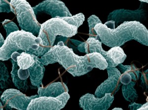 Microscopic Image of campylobacter jejuni