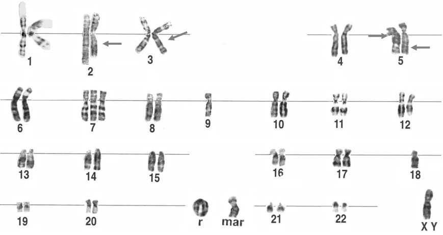 chromosome