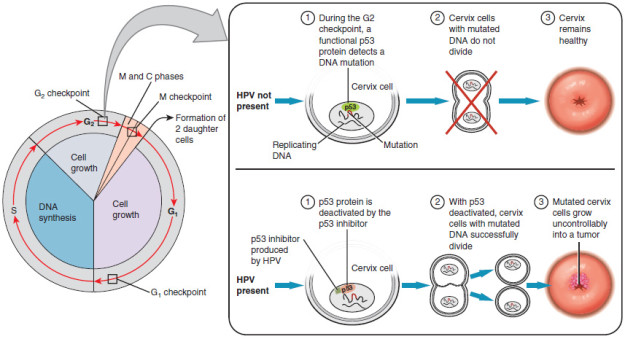 development of cervical cancer