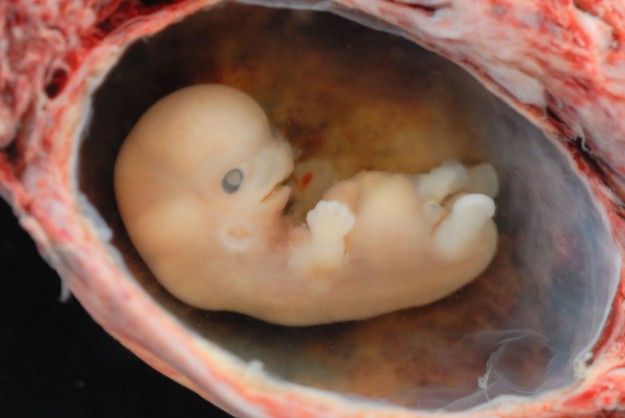 Human Embryo