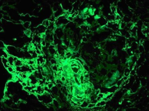 glomerular capillary wall