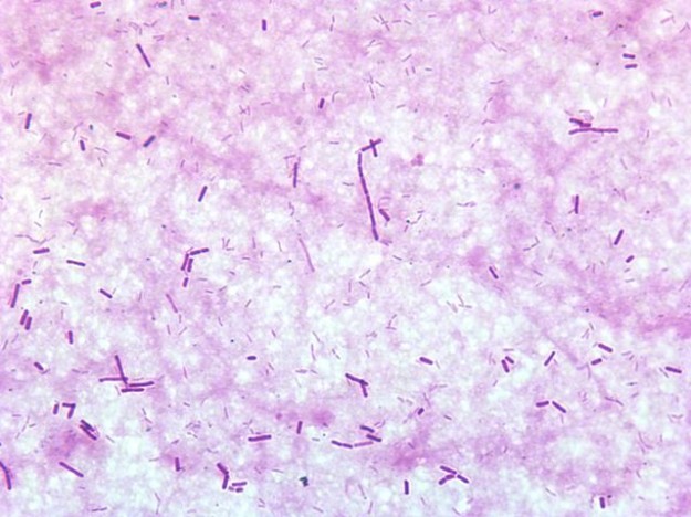 gram stained clostridium perfringens