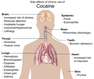 side effects of chronic use of cocaine