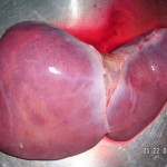 Human Liver Human Liver