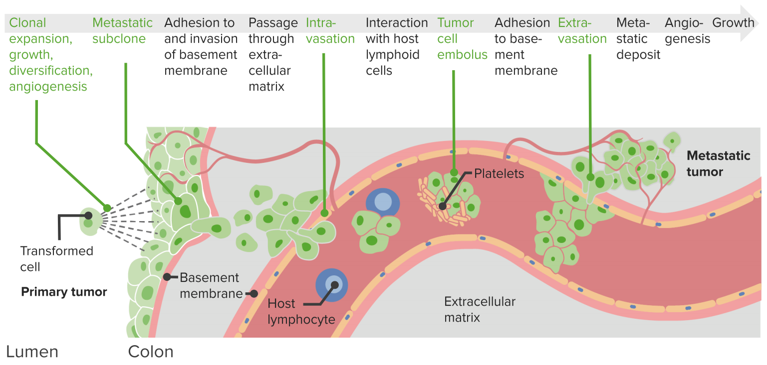 Cytopathology: Tumor Definition, Development & Metastases