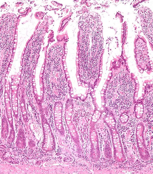 micrograph of small intestinal mucosa